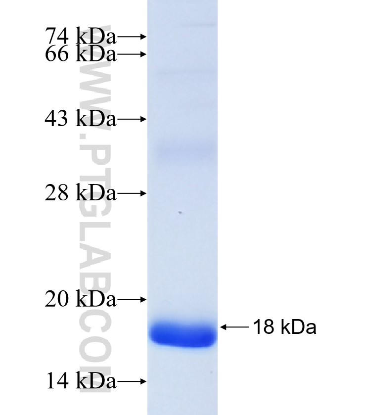 IGFBP7 fusion protein Ag33208 SDS-PAGE IGFBP7 fusion protein Ag33208 SDS-PAGE