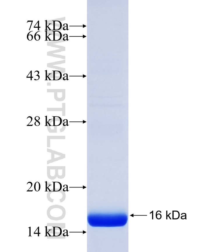 IGFL3 fusion protein Ag37024 SDS-PAGE IGFL3 fusion protein Ag37024 SDS-PAGE