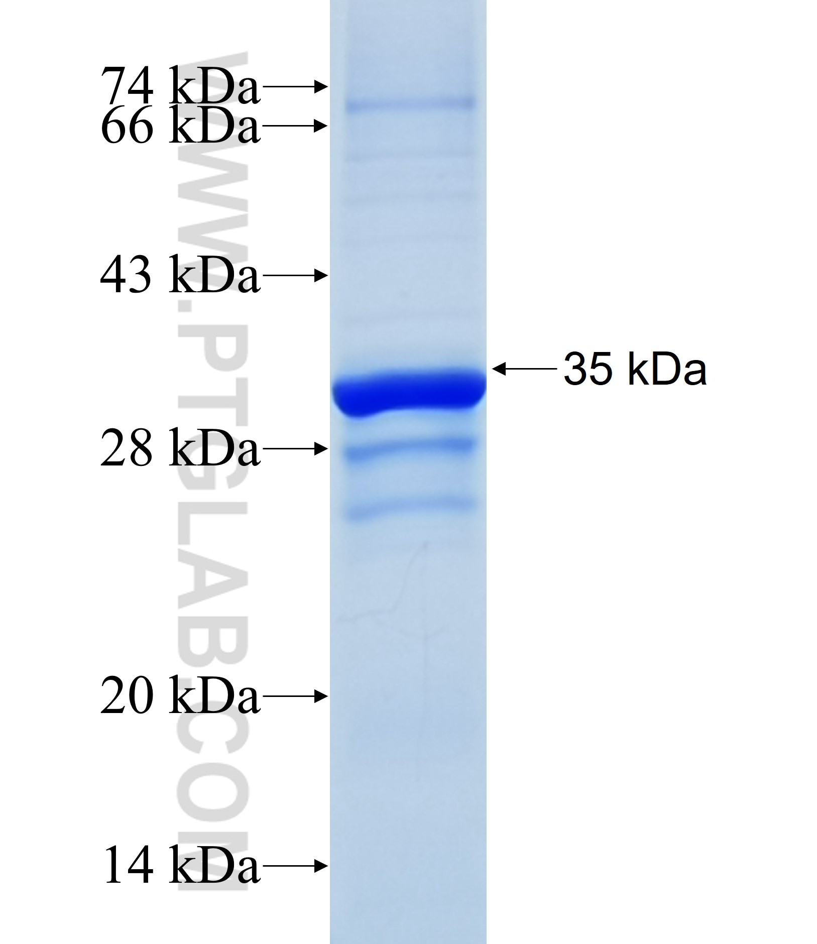 IGFL3 fusion protein Ag37113 SDS-PAGE IGFL3 fusion protein Ag37113 SDS-PAGE