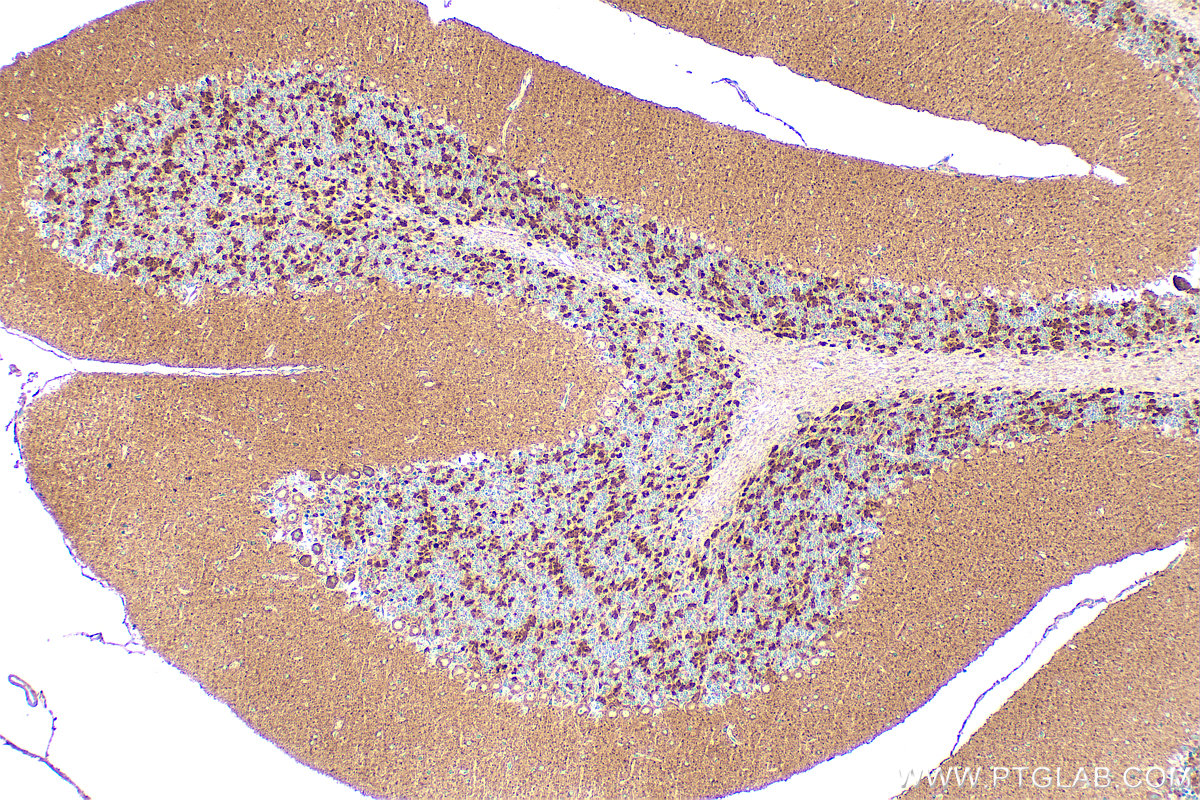IHC staining of mouse cerebellum using 33339-1-AP IHC staining of mouse cerebellum using 33339-1-AP