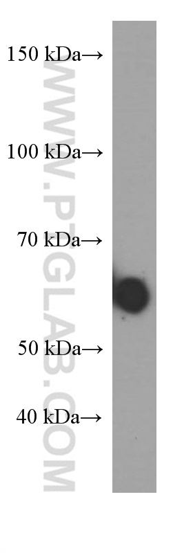 WB analysis of human saliva using 60099-1-Ig