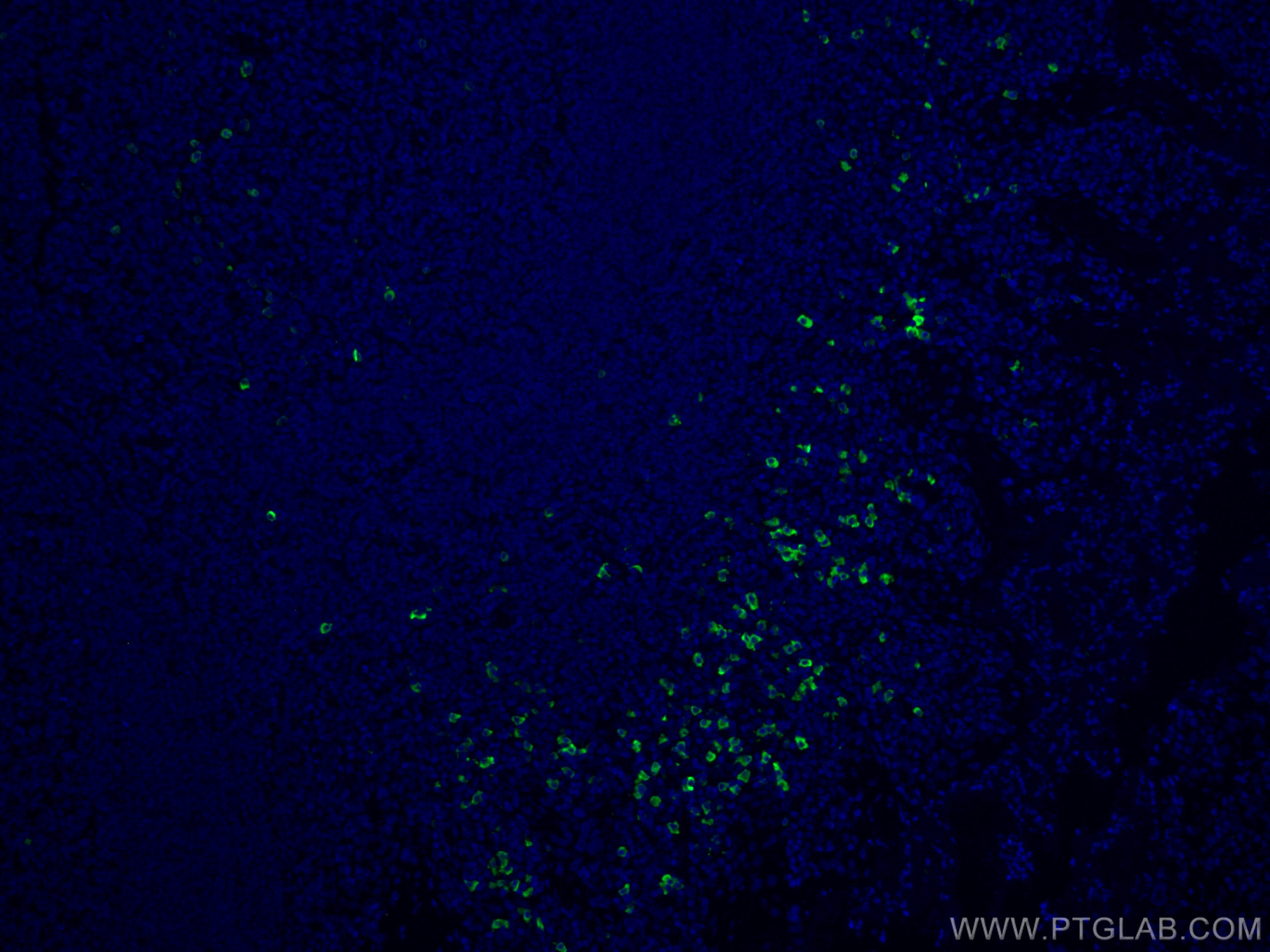 IF Staining of human tonsillitis using CL488-16489