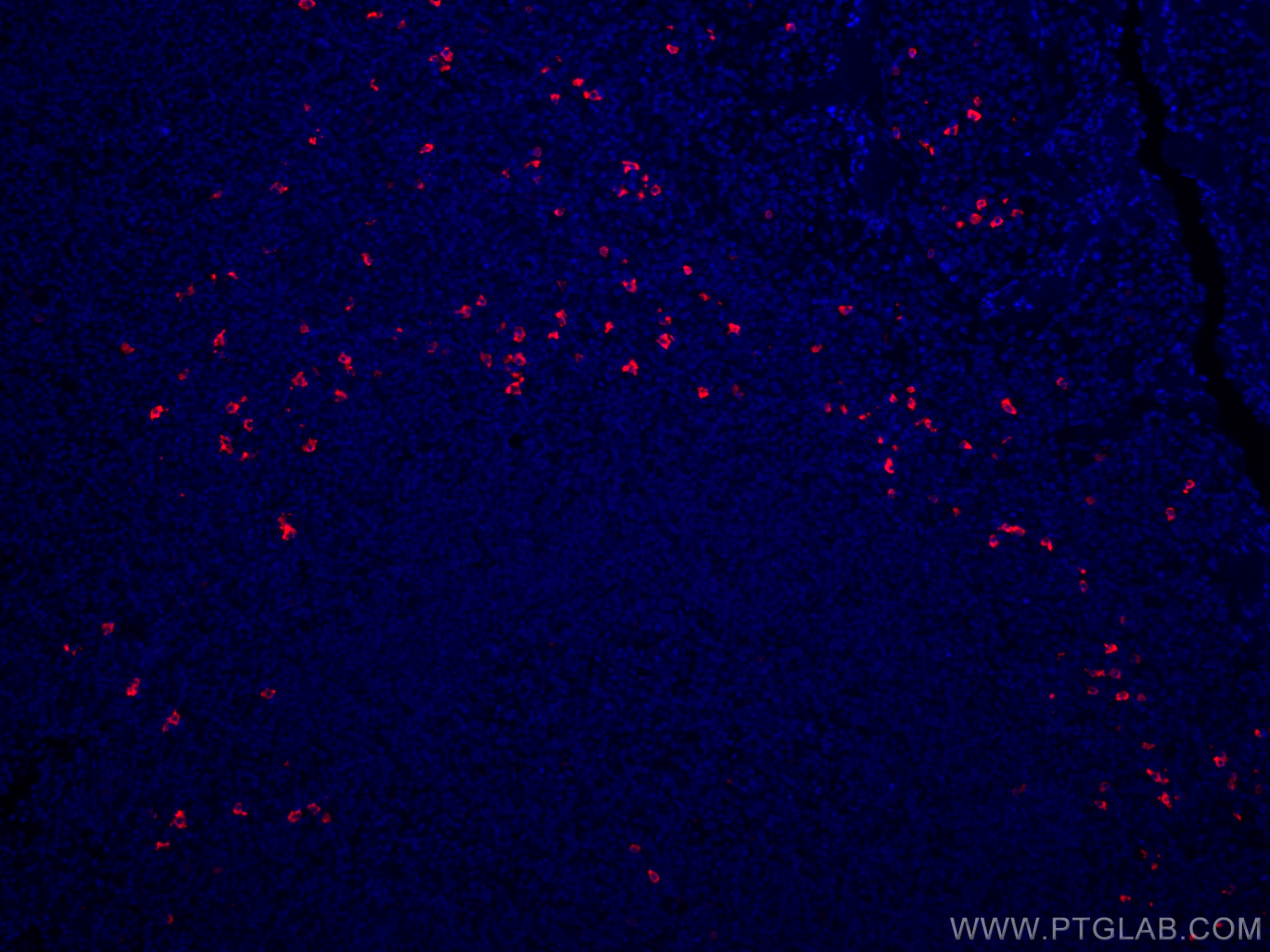 IF Staining of human tonsillitis using CL594-16489