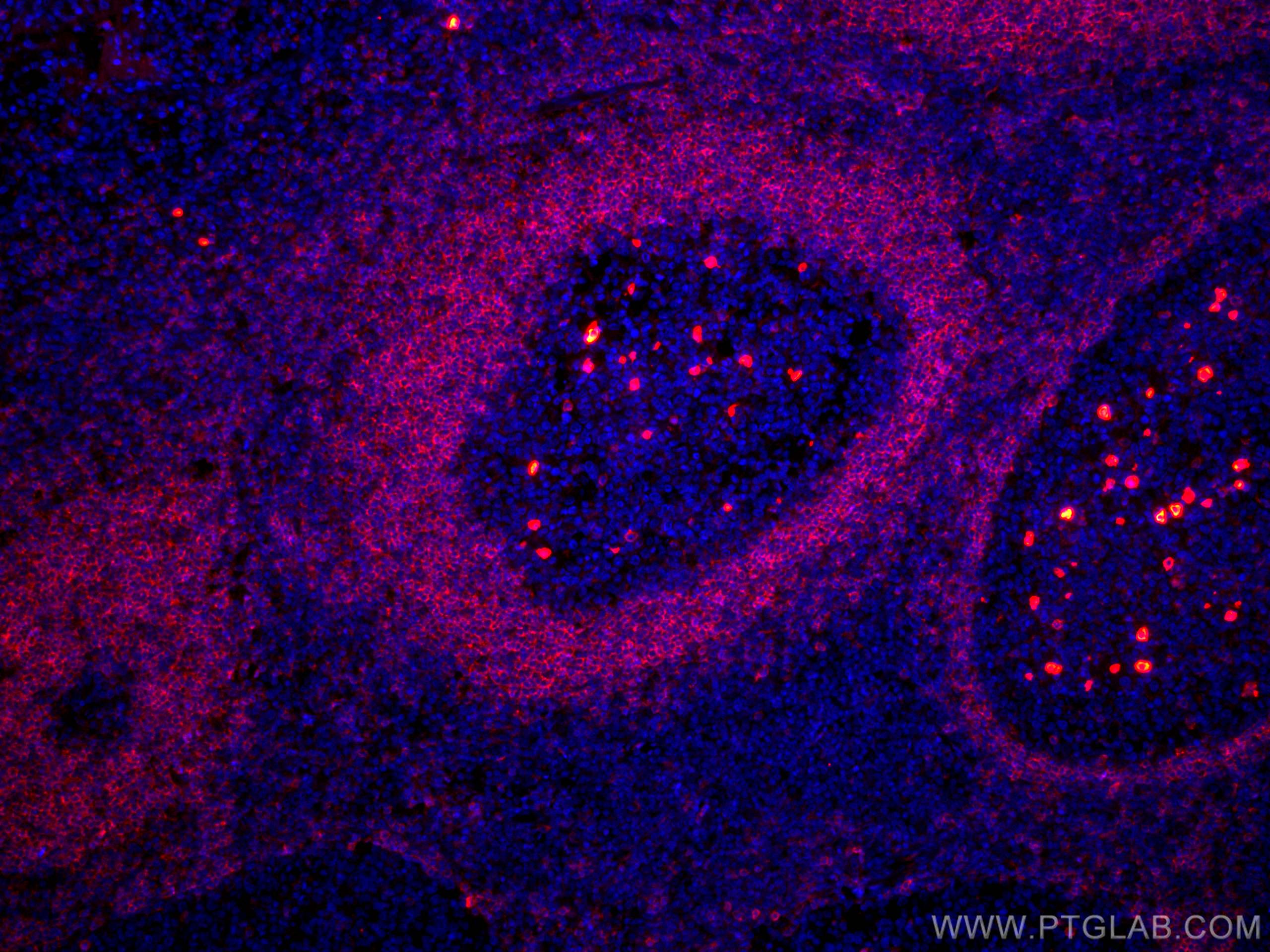 IF Staining of human tonsillitis using CL594-67538