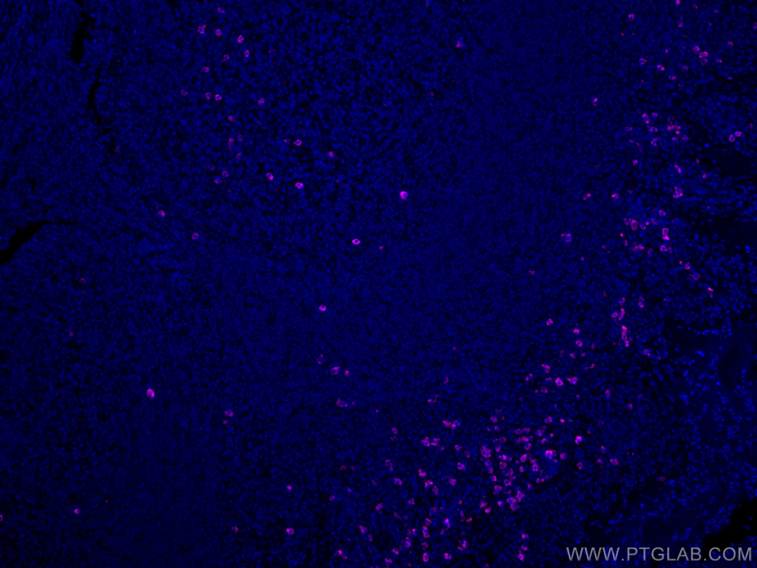 IF Staining of human tonsillitis using CL647-16489