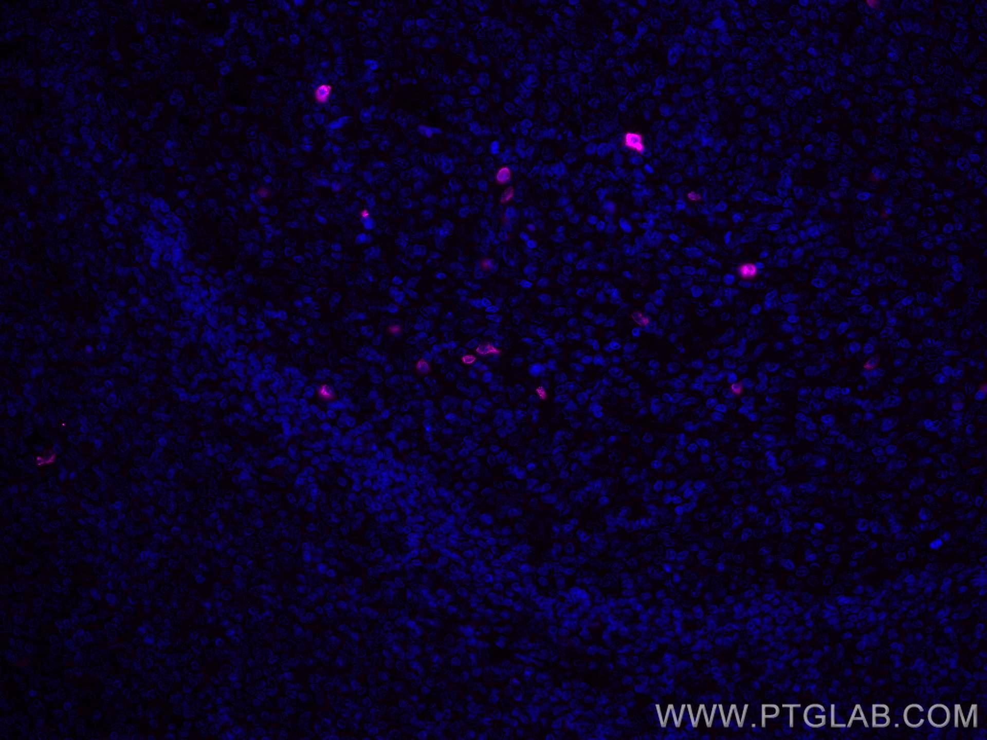 IF Staining of human tonsillitis using CL647-67538