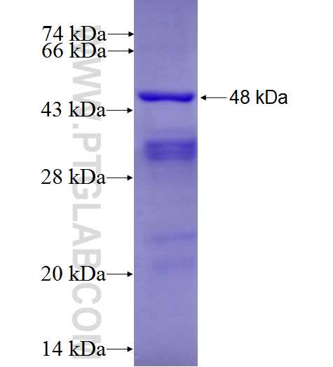 IGHD fusion protein Ag9645 SDS-PAGE IGHD fusion protein Ag9645 SDS-PAGE