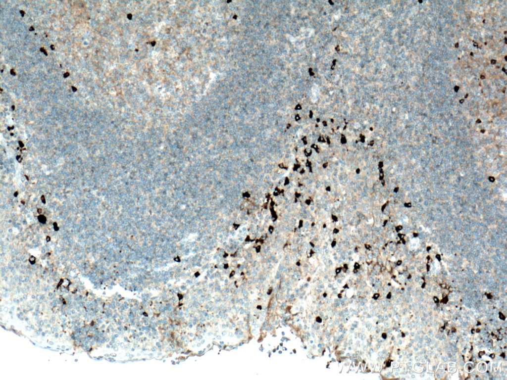 IHC staining of human tonsillitis using Biotin-66408