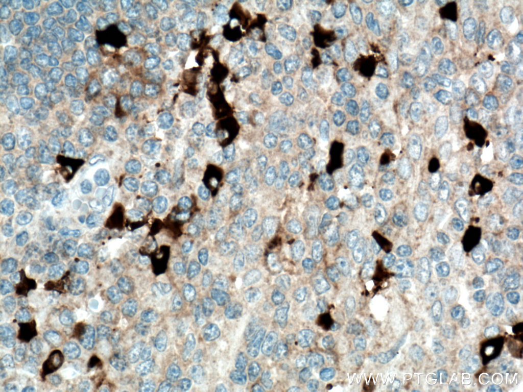 IHC staining of human tonsillitis using Biotin-66408