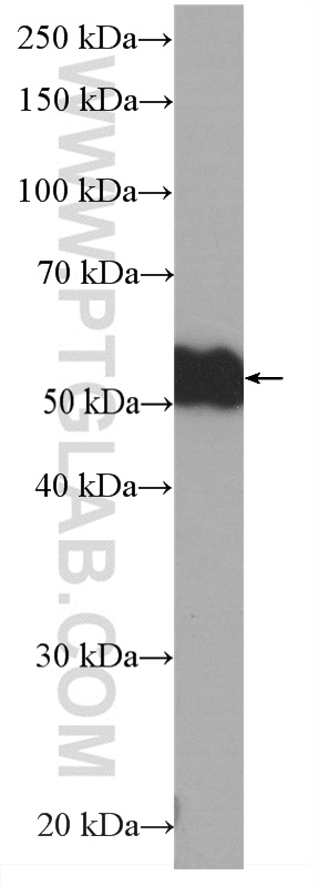 WB analysis of human plasma using HRP-66408