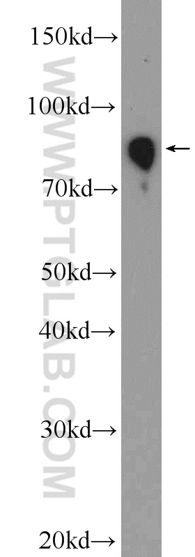 WB analysis of human plasma using 11016-1-AP