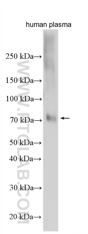 WB analysis using 11016-1-AP (same clone as 11016-1-PBS)