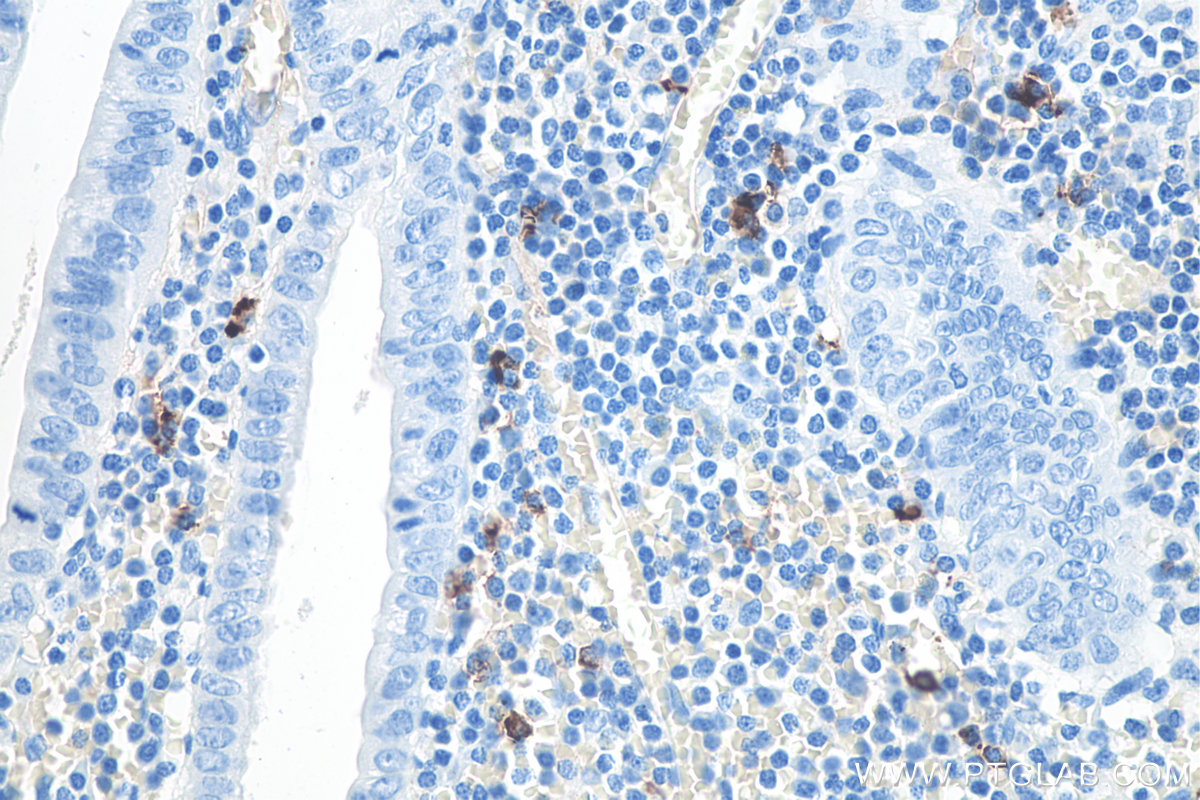 IHC staining of human appendicitis using 66484-1-Ig