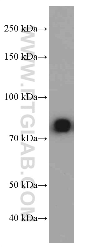 WB analysis of Human plasma using 66484-1-Ig