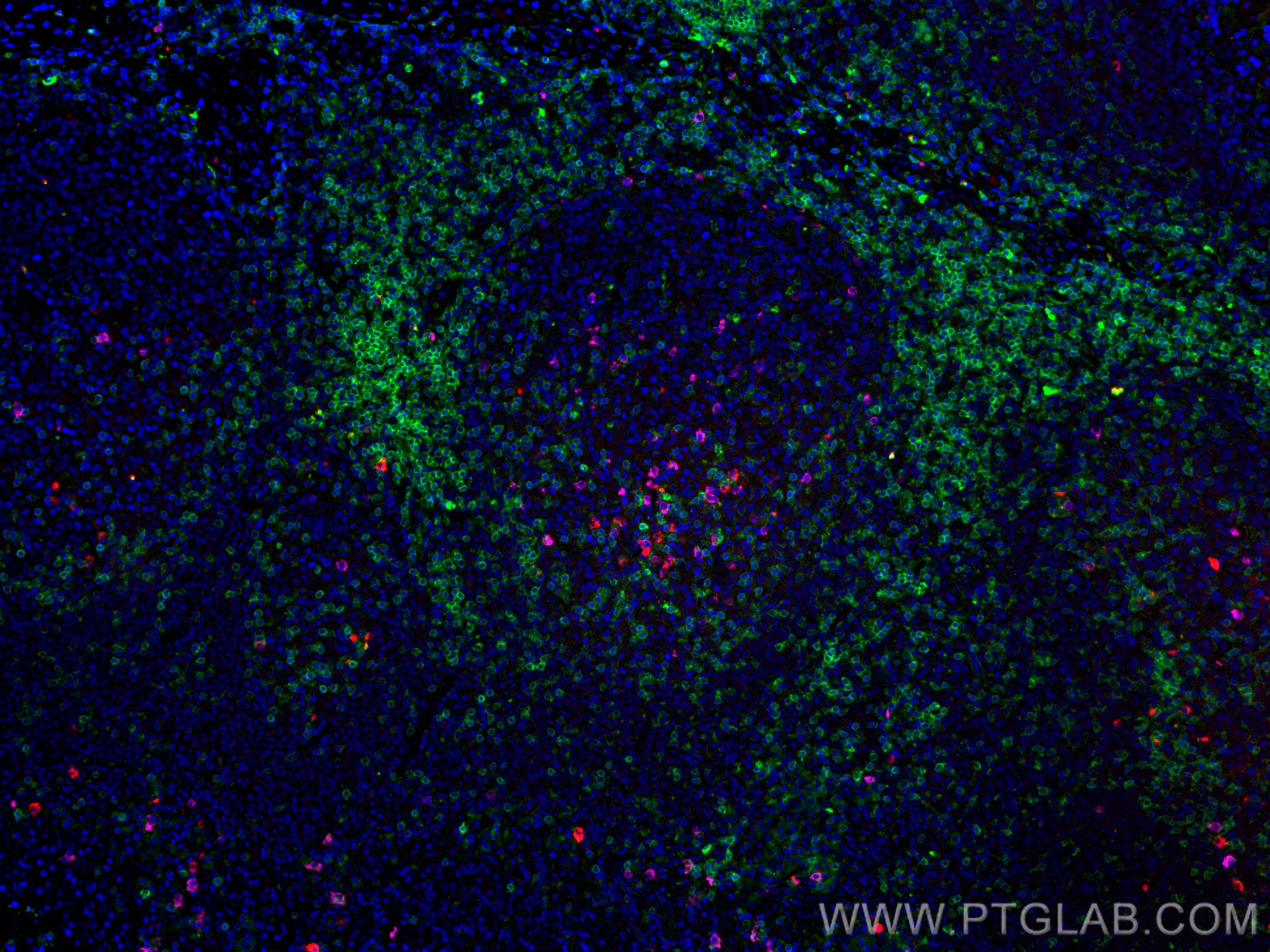 IF Staining of human tonsillitis using CL594-66484