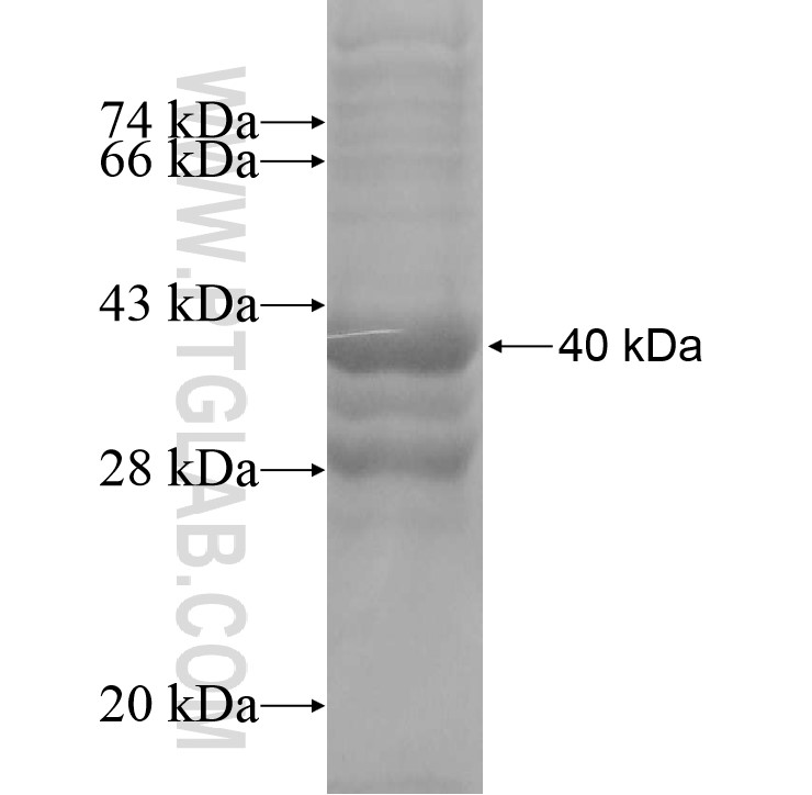 IGHV7-81 fusion protein Ag11082 SDS-PAGE IGHV7-81 fusion protein Ag11082 SDS-PAGE
