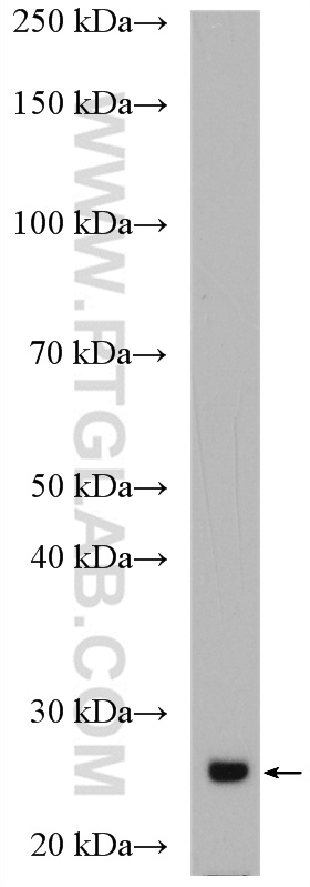 WB analysis of human plasma using 13688-1-AP
