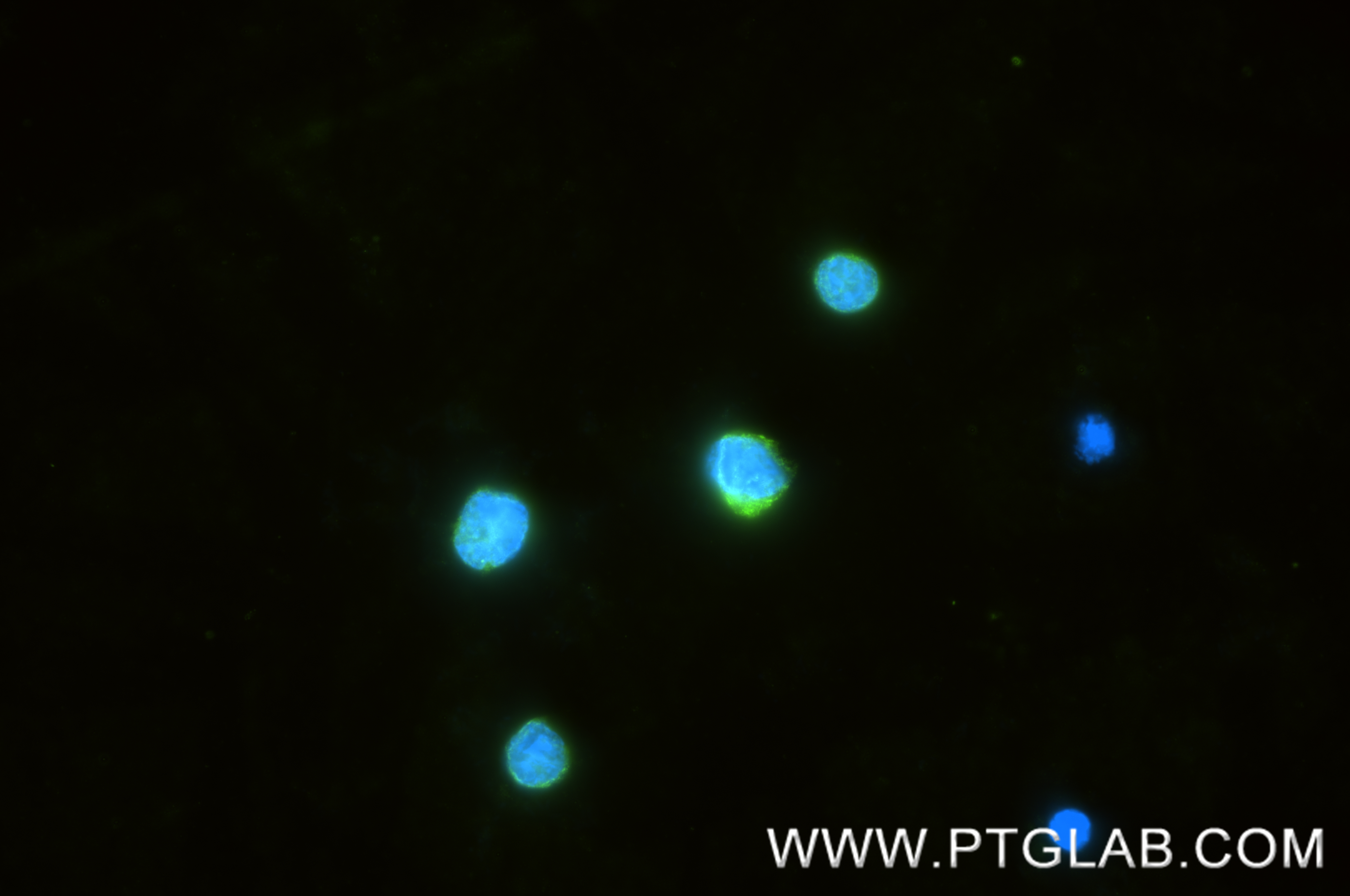 IF Staining of Ramos using 86939-1-RR (same clone as 86939-1-PBS) IF Staining of Ramos using 86939-1-RR (same clone as 86939-1-PBS)