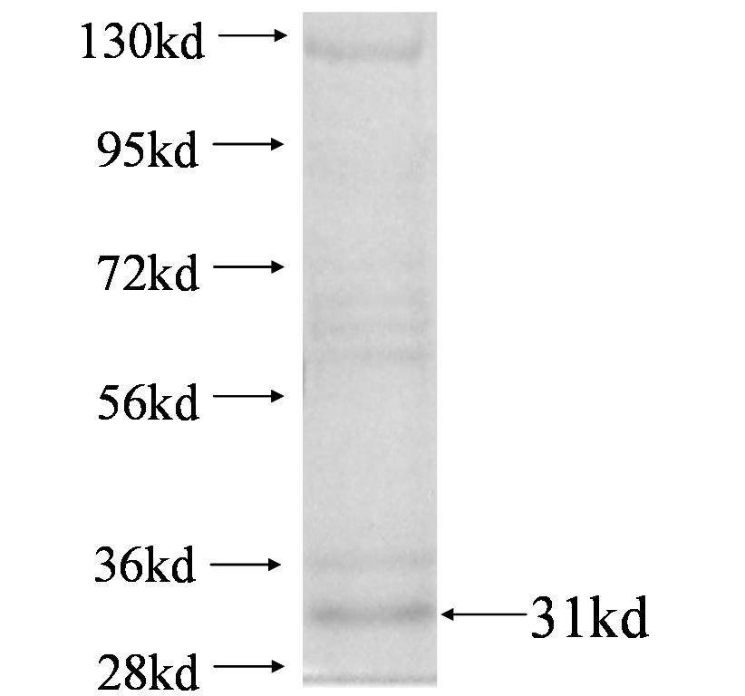 IGKV1-5 fusion protein Ag4378 SDS-PAGE