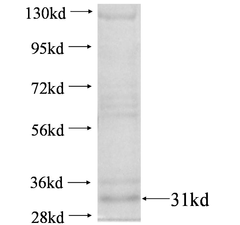 IGKV1-5 fusion protein Ag4378 SDS-PAGE IGKV1-5 fusion protein Ag4378 SDS-PAGE