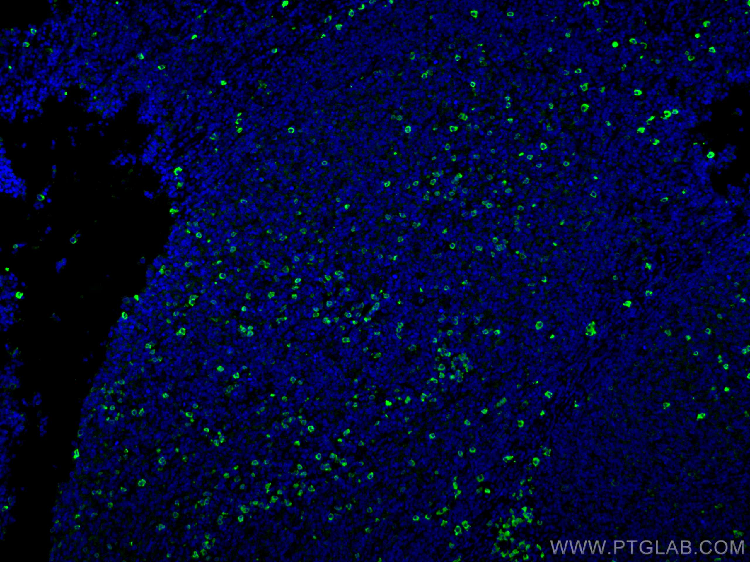 IF Staining of human tonsillitis using 11541-1-AP