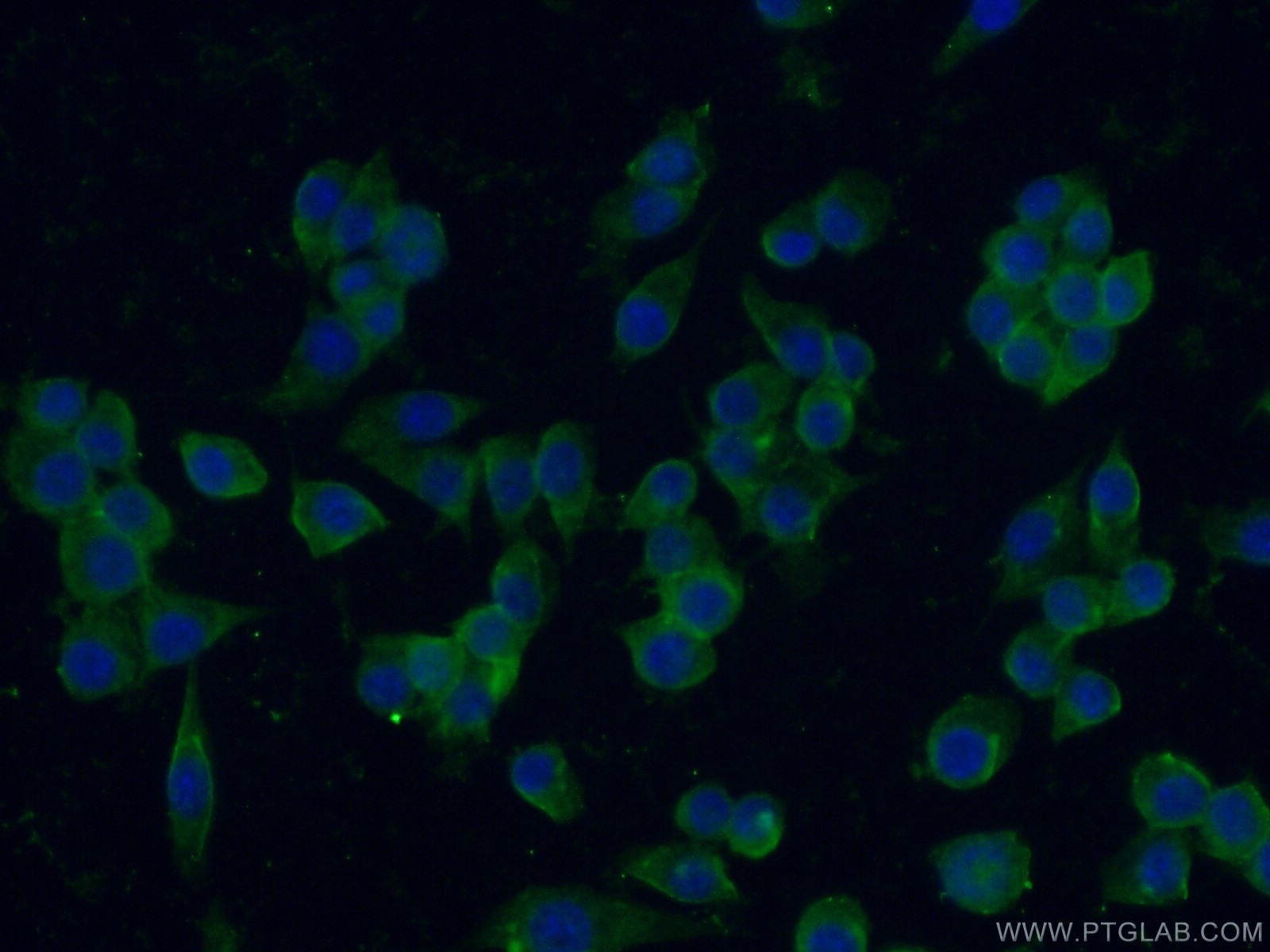 IF Staining of RAW 264.7 using 26047-1-AP