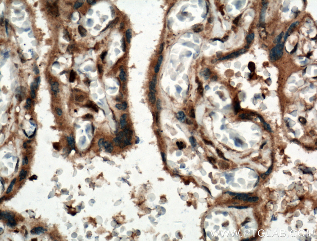 IHC staining of human placenta using 26047-1-AP