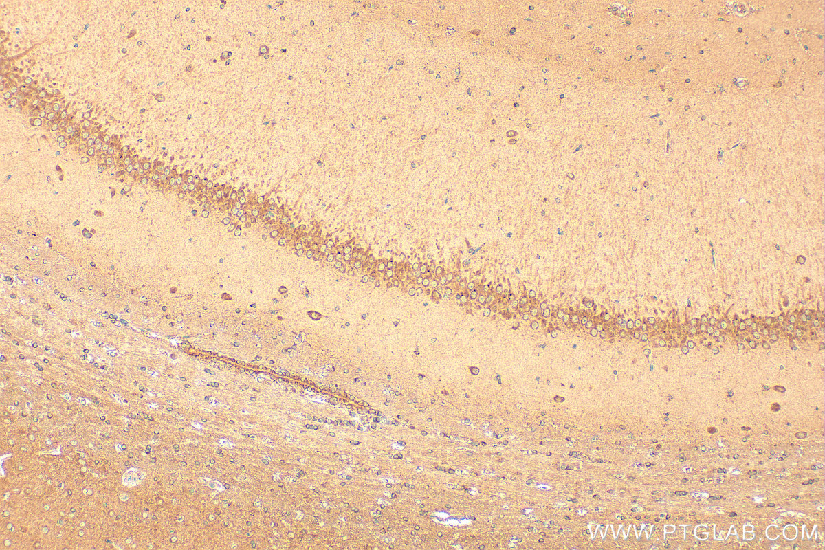 Immunohistochemical analysis of paraffin-embedded rat brain tissue slide using 21465-1-AP (IGSF21 antibody) at dilution of 1:200 (under 10x lens). Heat mediated antigen retrieval with Tris-EDTA buffer (pH 9.0). IHC staining of rat brain using 21465-1-AP
