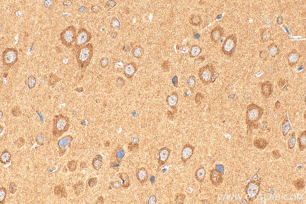 Immunohistochemical analysis of paraffin-embedded rat brain tissue slide using 21465-1-AP (IGSF21 antibody) at dilution of 1:200 (under 40x lens). Heat mediated antigen retrieval with Tris-EDTA buffer (pH 9.0). IHC staining of rat brain using 21465-1-AP