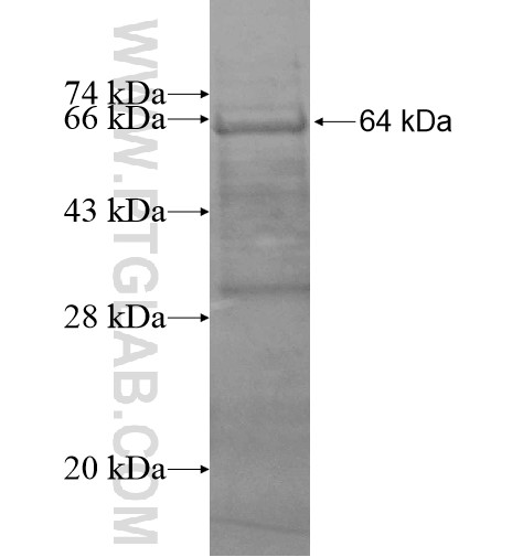 IGSF21 fusion protein Ag15054 SDS-PAGE IGSF21 fusion protein Ag15054 SDS-PAGE