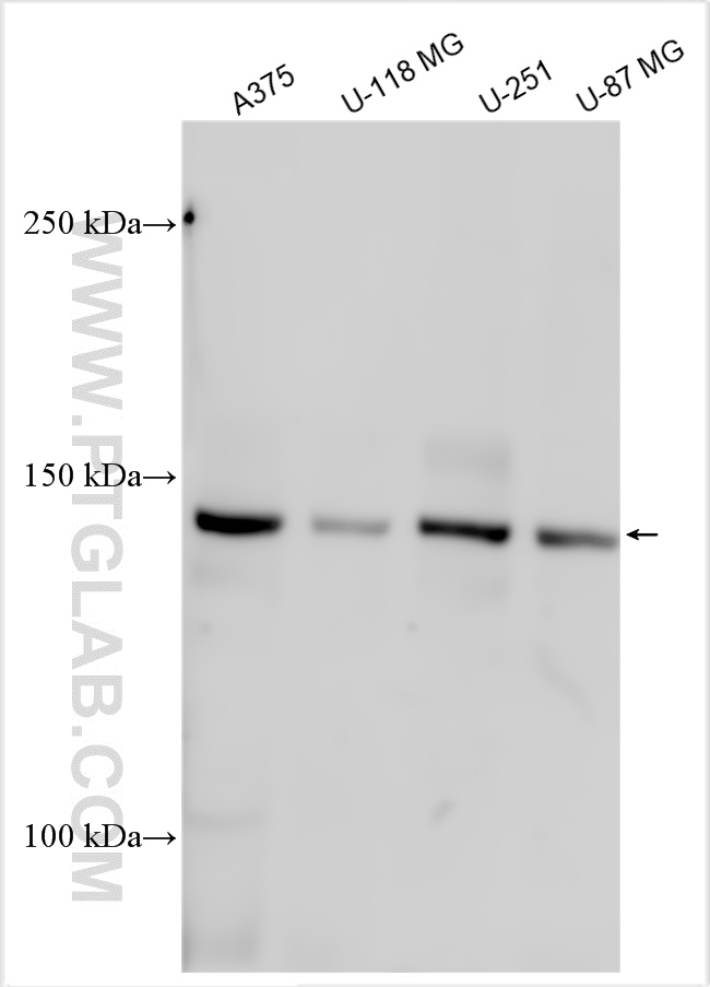 WB analysis using 18072-1-AP