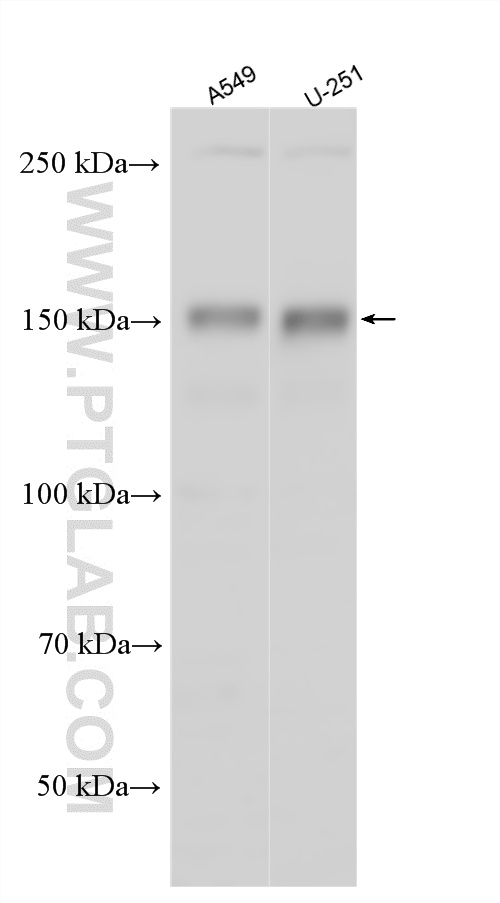 WB analysis using 18072-1-AP