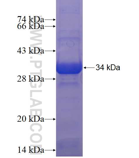 IGSF5 fusion protein Ag18169 SDS-PAGE IGSF5 fusion protein Ag18169 SDS-PAGE