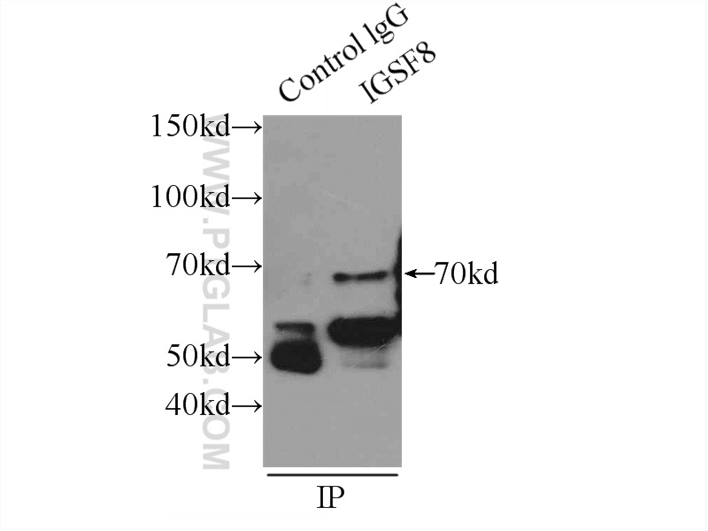 IP experiment of mouse brain using 14387-1-AP