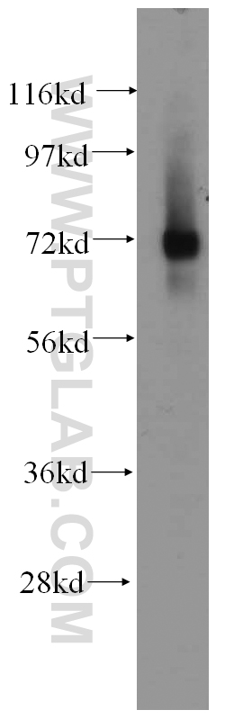 WB analysis of K-562 using 14387-1-AP