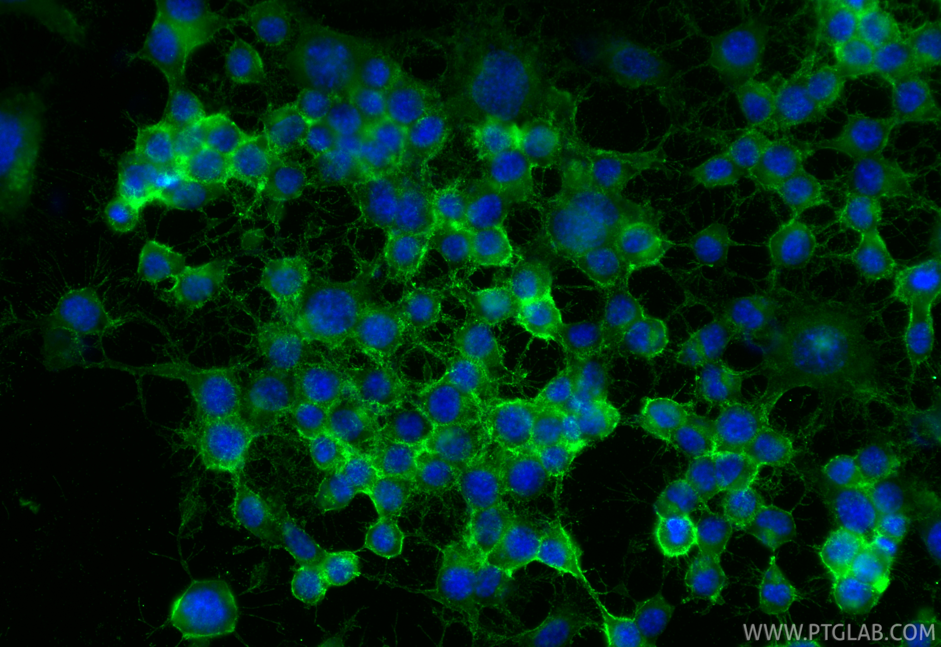 IF Staining of Neuro-2a using 33948-1-AP