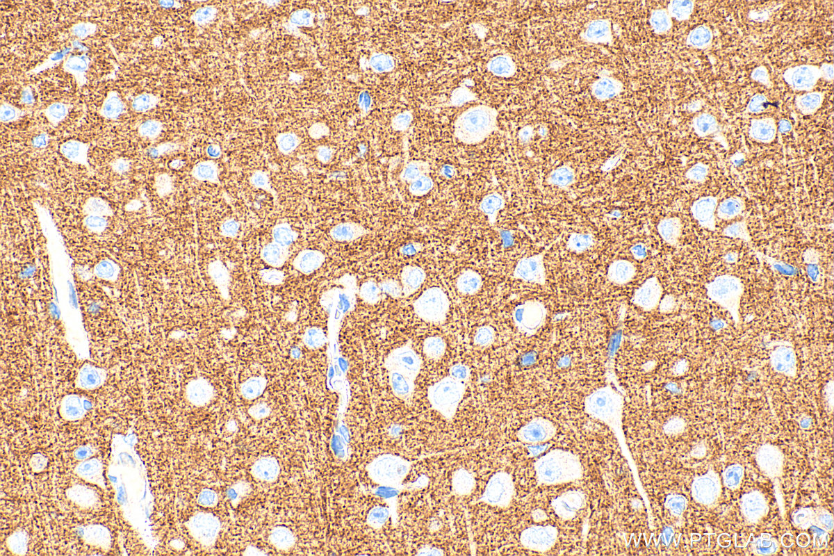IHC staining of mouse brain using 33948-1-AP