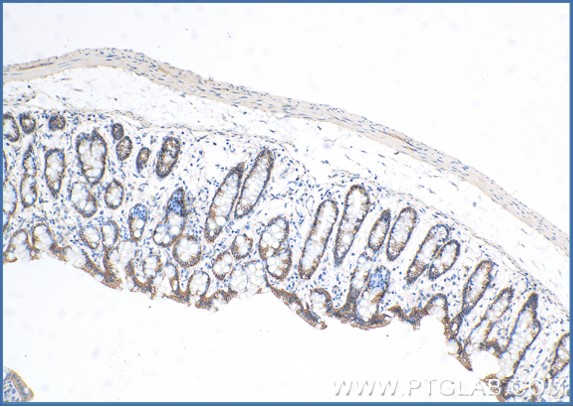 Immunohistochemical analysis of paraffin-embedded mouse colon tissue slide with anti-E-cadherin  ​Antibody(20874-1-AP) labeled with FlexAble HRP Antibody Labeling Kit for Rabbit IgG (KFA005). Antibody used at a dilution of 1:1000 under 10x and 40x lens.  Heat mediated antigen retrieval performed with Tris-EDTA buffer (pH 9.0) and DAB substrate was used for detection.