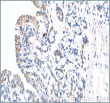 Immunohistochemical analysis of paraffin-embedded Rabbit colon tissue using anti-Cytokeratin 20 antibody (17329-1-AP) labeled with FlexAble Biotin Antibody Labeling Kit for Rabbit IgG (KFA007) and used at a dilution of 1:1000 (under 40x lens). Streptavidin Poly-HRP and DAB substrate was used for detection. Heat mediated antigen retrieval performed with Tris-EDTA buffer (pH 9.0).