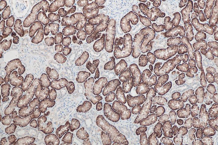 使用 Proteintech 的 SLC13A3 兔多克隆抗体 (26184-1-AP) 和兔一抗自主全应用免疫组化试剂盒 (PK10017) 对人肾脏组织进行免疫组织化学分析。