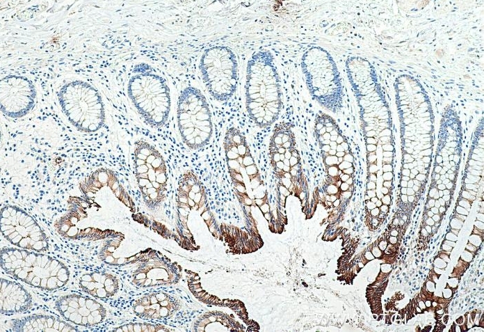 使用 Proteintech 的 Cytokeratin 19 小鼠单克隆抗体 (60187-1-Ig) 和抗小鼠自主全应用免疫组化试剂盒 (PK10018) 对人结肠组织进行免疫组织化学分析。