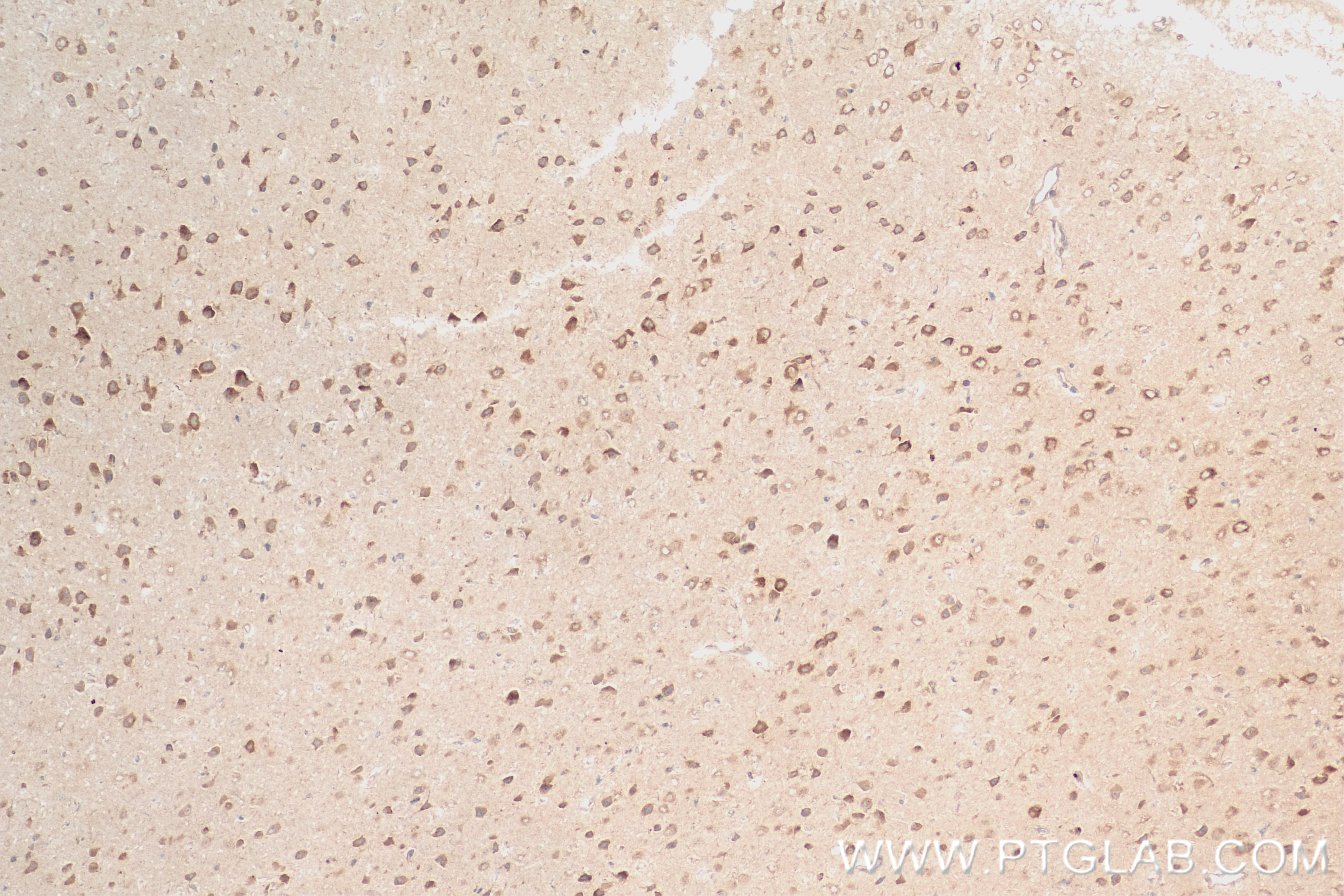 Immunohistochemical analysis of paraffin-embedded mouse brain tissue slide using 84826-1-RR (P62,SQSTM1 antibody) at dilution of 1:400 (under 10x lens). Heat mediated antigen retrieval with Tris-EDTA buffer (pH 9.0).