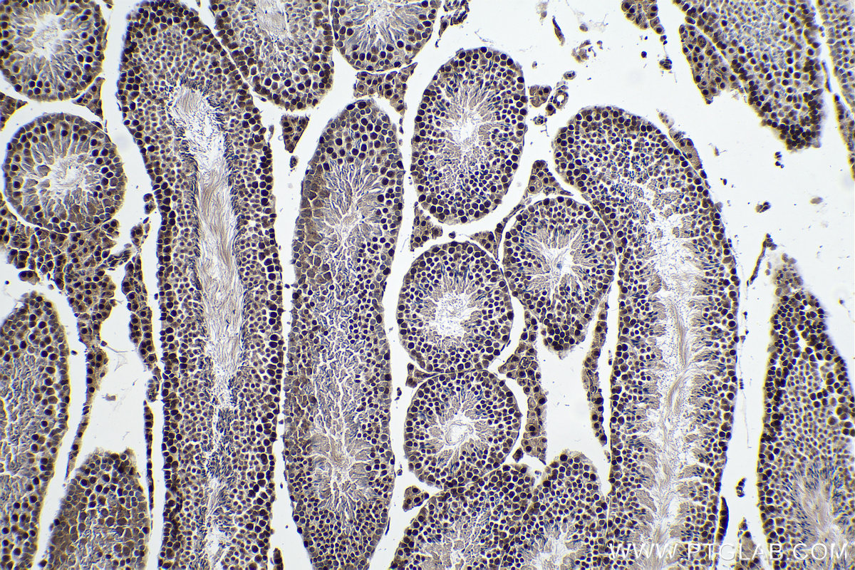 Immunohistochemical analysis of paraffin-embedded mouse testis tissue slide using 67811-1-Ig (ALKBH5 antibody) at dilution of 1:1000 (under 10x lens). Heat mediated antigen retrieval with Tris-EDTA buffer (pH 9.0).