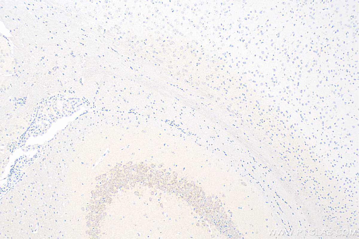 Immunohistochemical analysis of paraffin-embedded mouse brain tissue slide using 67298-1-Ig (LIAS antibody) at dilution of 1:1000 (under 10x lens). Heat mediated antigen retrieval with Tris-EDTA buffer (pH 9.0).