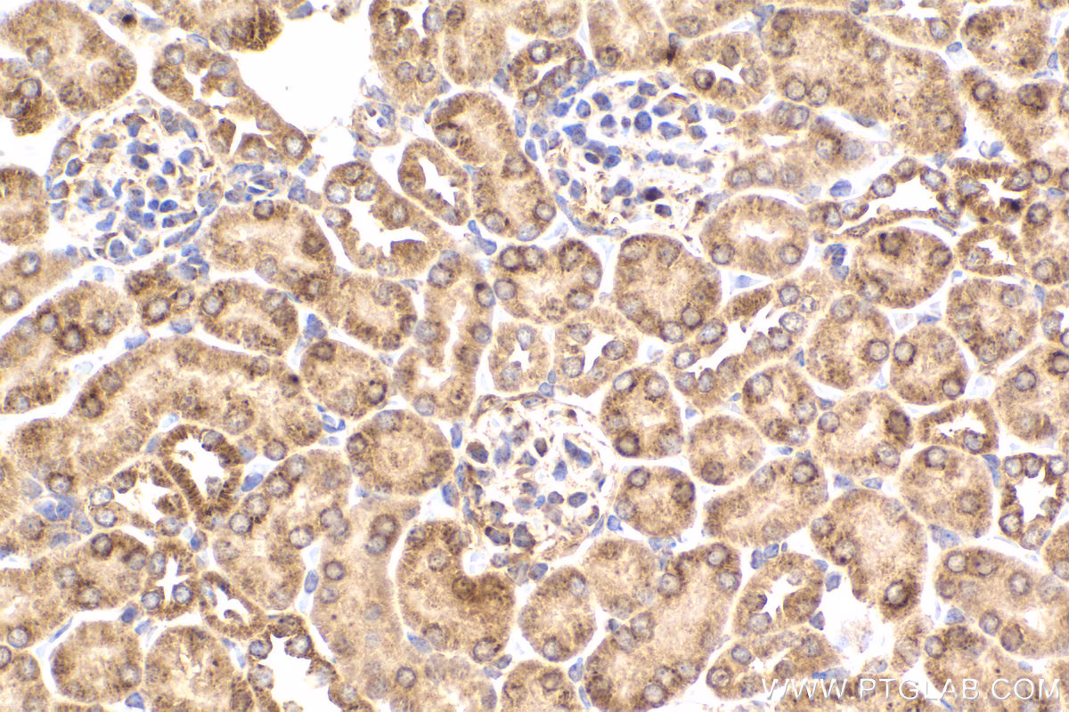 Immunohistochemical analysis of paraffin-embedded mouse kidney tissue slide using 68238-1-Ig (PDHB antibody) at dilution of 1:1000 (under 40x lens). Heat mediated antigen retrieval with Tris-EDTA buffer (pH 9.0).