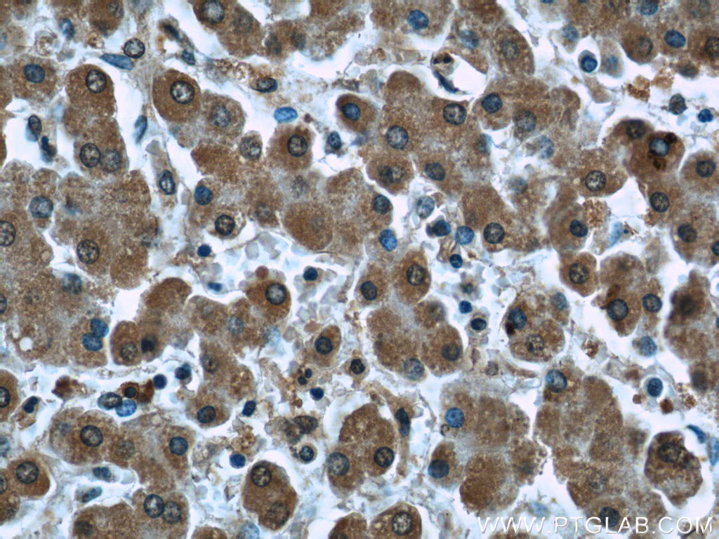 Immunohistochemical analysis of paraffin-embedded human liver tissue slide using 66119-1-Ig (PDH E1α antibody at dilution of 1:50(under 40x lens).