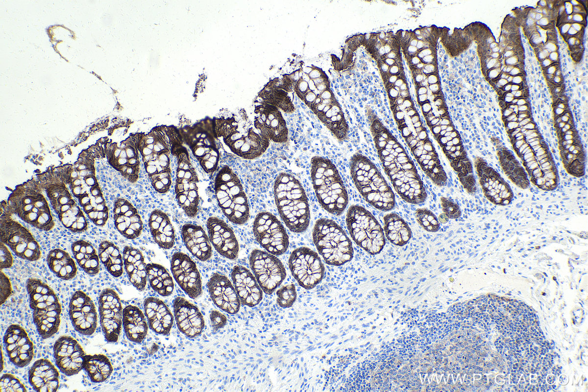 Immunohistochemical analysis of paraffin-embedded human colon tissue slide using 66096-1-Ig (Villin antibody) at dilution of 1:5000 (under 10x lens). Heat mediated antigen retrieval with Tris-EDTA buffer (pH 9.0). Multi-rAb Polymer HRP conjugated Goat anti-mouse Recombinant secondary antibody RGAM011 was used for detection. 