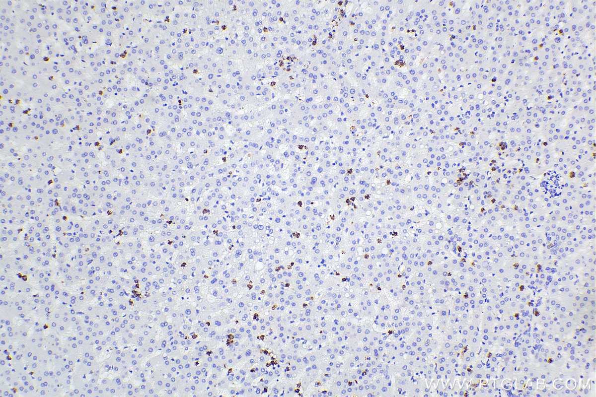 Immunohistochemical analysis of paraffin-embedded human liver tissue slide using 66177-1-Ig (MPO antibody) at dilution of 1:5000 (under 10x lens). Heat mediated antigen retrieval with Tris-EDTA buffer (pH 9.0). Multi-rAb™ Polymer HRP-Goat anti-Mouse Recombinant secondary antibody RGAM011 was used for detection. The staining was performed on Celnovte's CNT360-M1 autostainer.