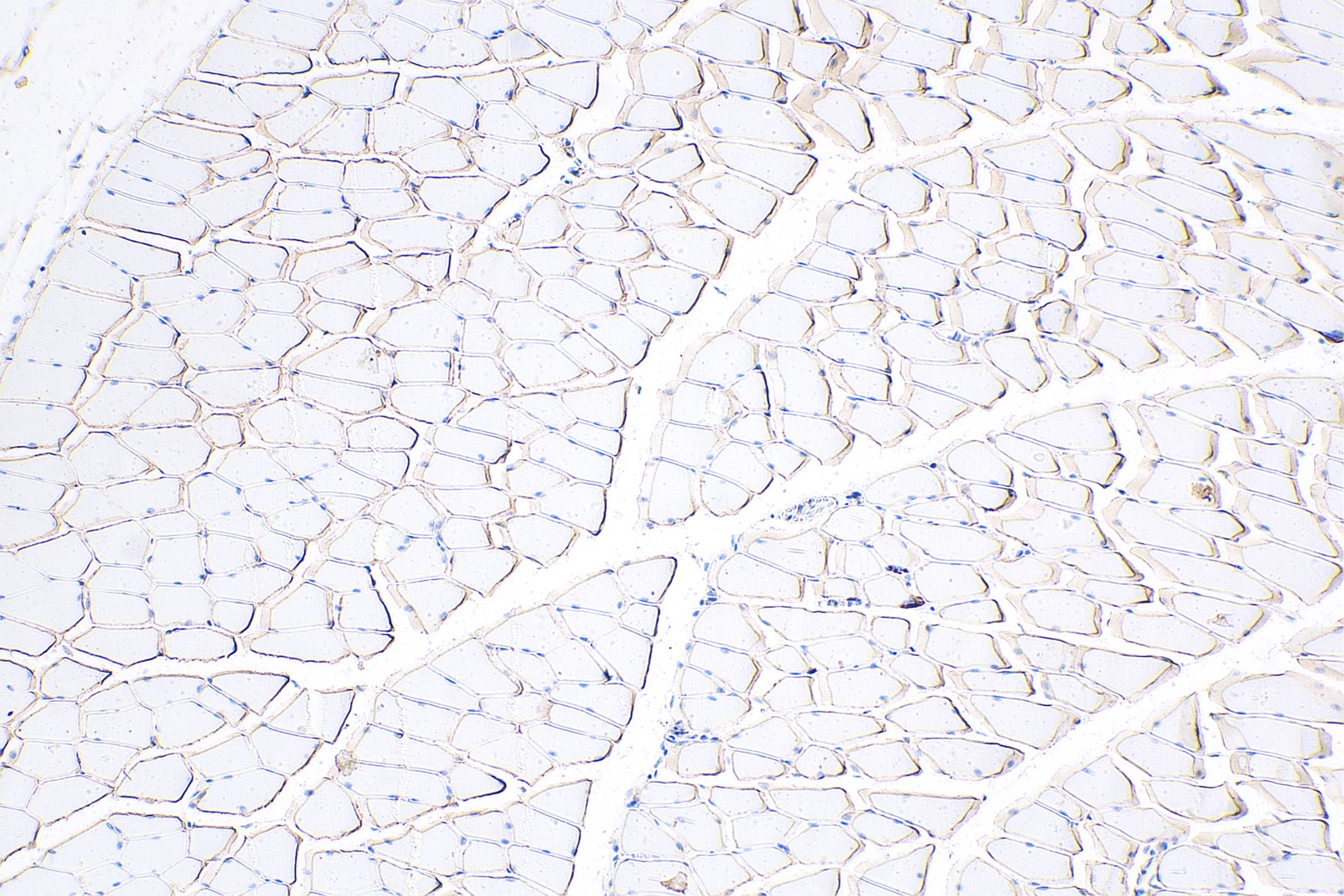 Immunohistochemical analysis of paraffin-embedded mouse skeletal muscle tissue slide using 12715-1-AP (Dystrophin polyclonal antibody) at dilution of 1:10000 (under 10x lens). Heat mediated antigen retrieval with Tris-EDTA buffer (pH 9.0). Multi-rAb™ Polymer HRP-Goat anti-rabbit Recombinant secondary antibody RGAR011 was used for detection.