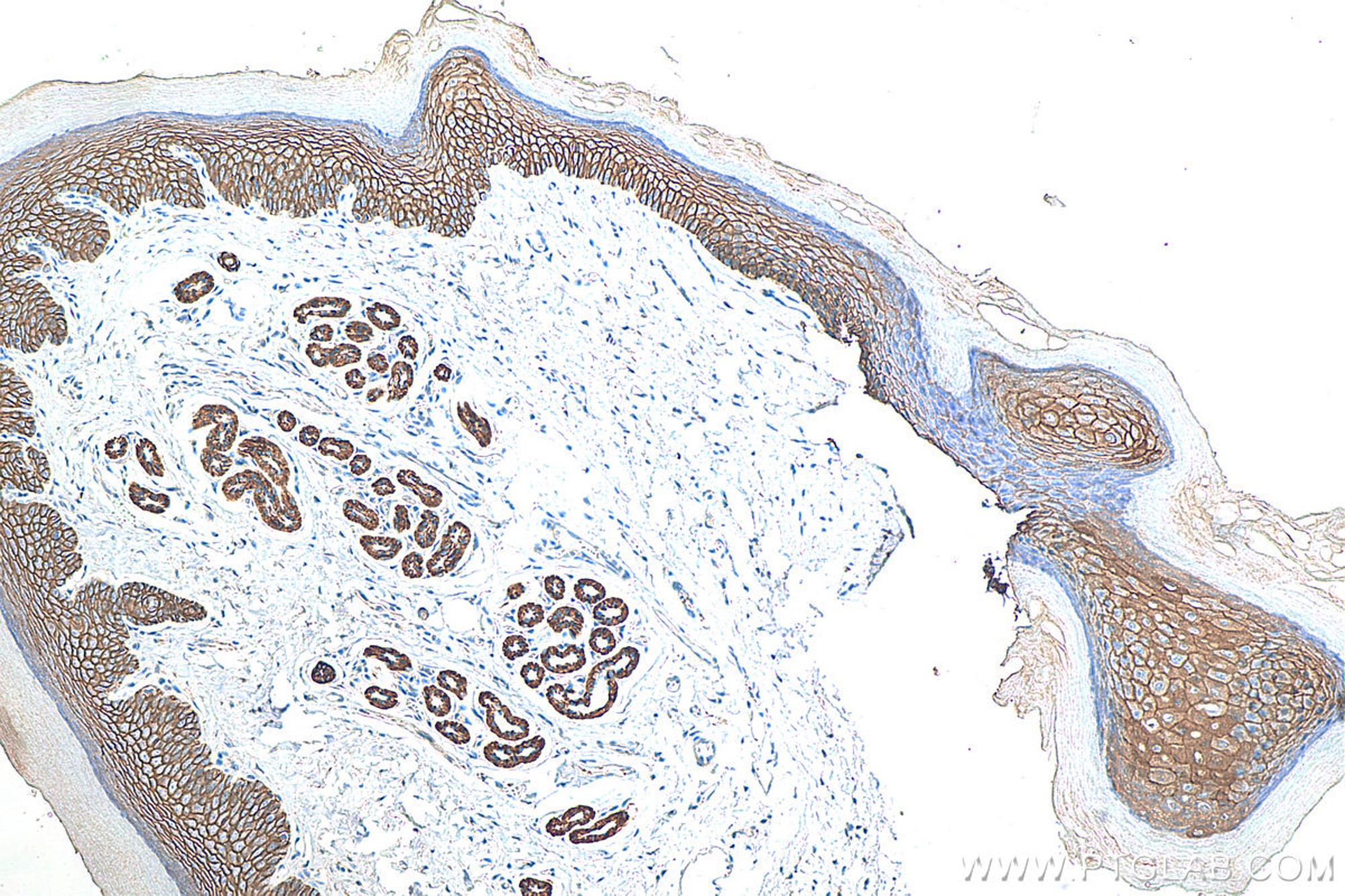 Immunohistochemical analysis of paraffin-embedded mouse skin tissue slide using 20874-1-AP (E-cadherin polyclonal antibody) at dilution of 1:5000 (under 10x lens). Heat mediated antigen retrieval with Tris-EDTA buffer (pH 9.0). Multi-rAb™ Polymer HRP-Goat anti-rabbit Recombinant secondary antibody RGAR011 was used for detection.